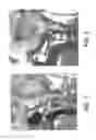 Fig. 02 - Craniospinal fusion method and apparatus