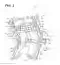 Fig. 03 - Craniospinal fusion method and apparatus
