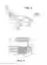 Fig. 04 - Craniospinal fusion method and apparatus