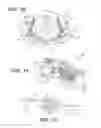 Fig. 06 - Craniospinal fusion method and apparatus