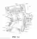 Fig. 07 - Craniospinal fusion method and apparatus