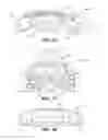 Fig. 09 - Craniospinal fusion method and apparatus