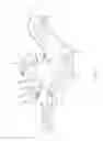 Fig. 05 - Orthopedic bone plate and locking tab apparatus and method of use