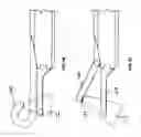 Fig. 28 - Methods and devices for treating pelvic conditions