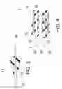 Fig. 04 - Methods of ablating tissue using a catheter injection system