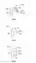 Fig. 03 - Dental prosthesis, apparatus and kit