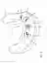 Fig. 06 - Attachment system for removable dental prosthesis and dental implant abutment