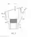 Fig. 08 - Attachment system for removable dental prosthesis and dental implant abutment