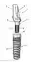 Fig. 01 - Metal pillar for dental implants