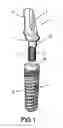 Fig. 02 - Metal pillar for dental implants
