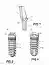 Fig. 03 - Metal pillar for dental implants