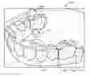 Fig. 01 - Mold with weakened areas