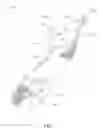 Fig. 02 - Disposable Flossing Assembly