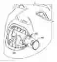 Fig. 01 - Intraoral device and method of use