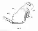 Fig. 03 - Intraoral device and method of use