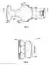 Fig. 05 - Intraoral device and method of use