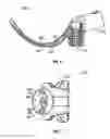 Fig. 06 - Intraoral device and method of use