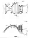 Fig. 07 - Intraoral device and method of use
