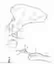Fig. 07 - MULTI-COMPONENT IMPLANT ASSEMBLY WITH DUAL ARTICULATING AND/OR ROTATING SURFACES