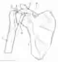 Fig. 01 - MULTI-COMPONENT SHOULDER IMPLANT ASSEMBLY WITH DUAL ARTICULATING SURFACES
