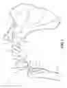 Fig. 03 - MULTI-COMPONENT SHOULDER IMPLANT ASSEMBLY WITH DUAL ARTICULATING SURFACES