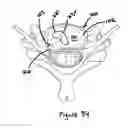 Fig. 20 - Devices and methods for treating tissue defects
