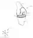 Fig. 01 - SYSTEMS AND METHODS FOR MOBILE BEARING PROSTHETIC KNEE