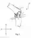Fig. 04 - SYSTEMS AND METHODS FOR MOBILE BEARING PROSTHETIC KNEE