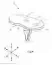 Fig. 07 - SYSTEMS AND METHODS FOR MOBILE BEARING PROSTHETIC KNEE