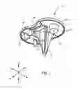 Fig. 08 - SYSTEMS AND METHODS FOR MOBILE BEARING PROSTHETIC KNEE
