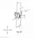 Fig. 17 - SYSTEMS AND METHODS FOR MOBILE BEARING PROSTHETIC KNEE