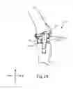 Fig. 25 - SYSTEMS AND METHODS FOR MOBILE BEARING PROSTHETIC KNEE