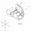 Fig. 26 - SYSTEMS AND METHODS FOR MOBILE BEARING PROSTHETIC KNEE
