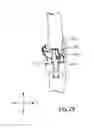 Fig. 29 - SYSTEMS AND METHODS FOR MOBILE BEARING PROSTHETIC KNEE