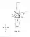 Fig. 31 - SYSTEMS AND METHODS FOR MOBILE BEARING PROSTHETIC KNEE