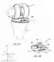Fig. 34 - SYSTEMS AND METHODS FOR MOBILE BEARING PROSTHETIC KNEE