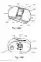 Fig. 35 - SYSTEMS AND METHODS FOR MOBILE BEARING PROSTHETIC KNEE