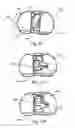 Fig. 37 - SYSTEMS AND METHODS FOR MOBILE BEARING PROSTHETIC KNEE