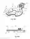Fig. 40 - SYSTEMS AND METHODS FOR MOBILE BEARING PROSTHETIC KNEE