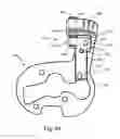 Fig. 49 - SYSTEMS AND METHODS FOR MOBILE BEARING PROSTHETIC KNEE
