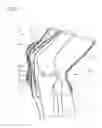 Fig. 02 - Knee brace