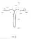 Fig. 06 - Intrauterine contraceptive device