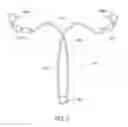 Fig. 08 - Intrauterine contraceptive device