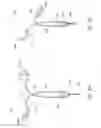 Fig. 09 - Intrauterine contraceptive device