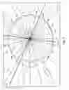 Fig. 02 - Intraocular lens alignment