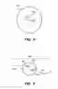 Fig. 06 - Method and system for modifying eye tissue and intraocular lenses
