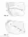 Fig. 11 - Method and system for modifying eye tissue and intraocular lenses
