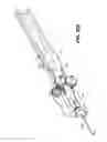 Fig. 13 - Ocular delivery systems and methods
