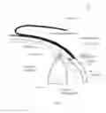 Fig. 02 - Method, surgical kit and device for treating glaucoma
