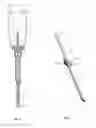 Fig. 03 - Method, surgical kit and device for treating glaucoma
